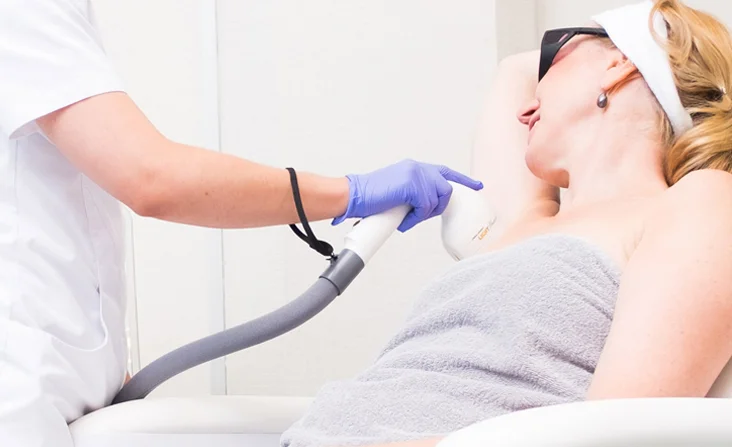 Laser hair removal