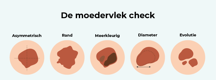 Moedervlekken MC Wetering